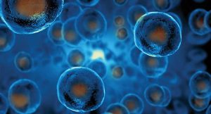 : A Phase 1 Trial Using CellReady® in Alzheimer’s Disease